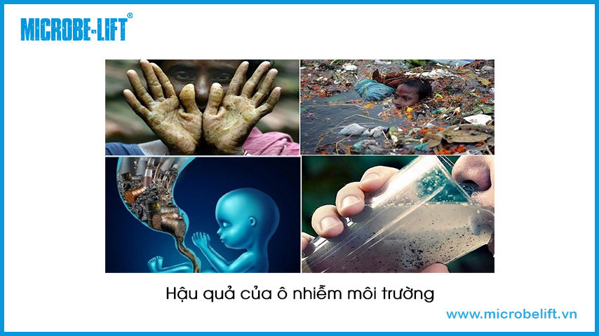 Ô nhiễm môi trường gây ra nhiều hệ lụy nghiêm trọng đến sức khỏe con người.